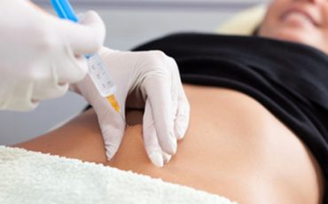 Holistic Mesotherapy