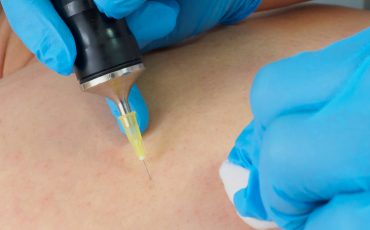 5 MesoTherapy and 5 CarboxyTherapy COMBO 5